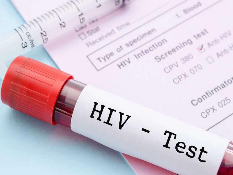La compañía señaló que, a diferencia de otros test de autodiagnóstico del HIV, este no requiere una muestra de sangre por pinchazo en el dedo, sino que detecta los anticuerpos específicos frente al virus (VIH-1 y VIH-2) en una muestra de saliva. 