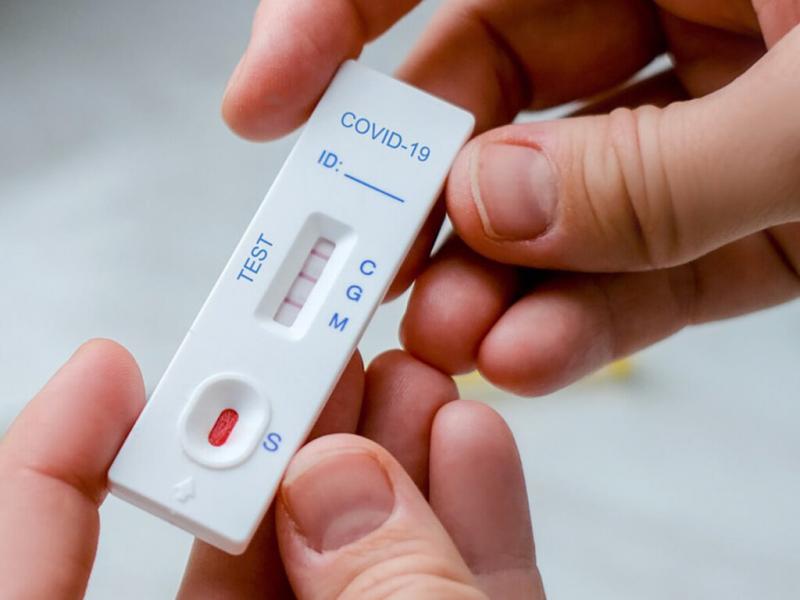 Cabe destacar que, en caso que el cuadro clnico del paciente lo requiera, el sistema de salud pblico como el privado seguir testeando a los pacientes, o bien existe la posibilidad de adquirir un autotest en las farmacias.